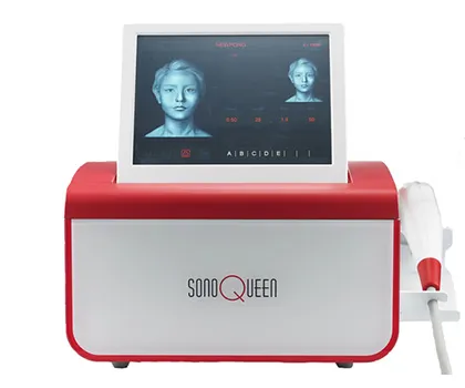 ソノクイーン（SonoQueen）